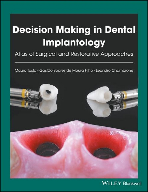 Decision Making in Dental Implantology - Mauro Tosta, Gastuo Soares De Moura Filho, Leandro Chambrone