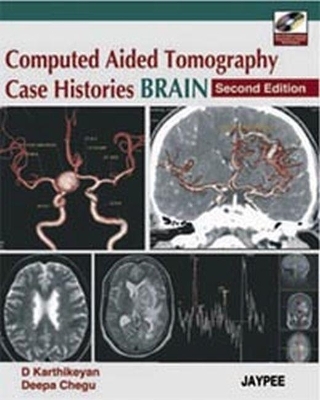 Computed Aided Tomography Case Histories Brain - D Karthikeyan, Deepa Chegu