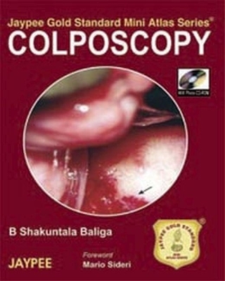 Jaypee Gold Standard Mini Atlas Series: Colposcopy - BS Baliga