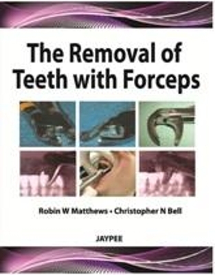 The Removal of Teeth with Forceps