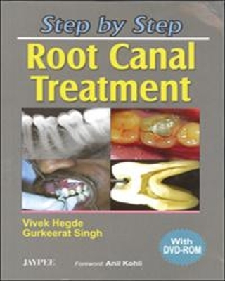Step by Step: Root Canal Treatment - Vivek Hegde, Gurkeerat Singh