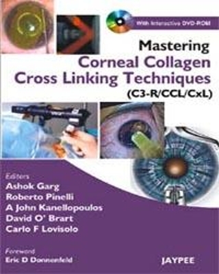Mastering Corneal Collagen Cross Linking Techniques (C3-R/CCL/CXL)