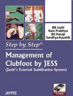 Step by Step: Management of Clubfoot by JESS (Joshi's External Stabilization System) - BB Joshi, Ram Prabhoo, BG Kanaji, Sandhya Kaushik