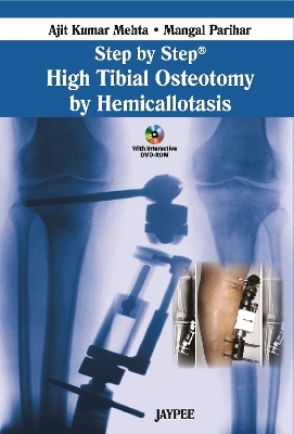 Step by Step: High Tibial Osteotomy by Hemicallotasis - Ajit Kumar Mehta, Mangal Parihar
