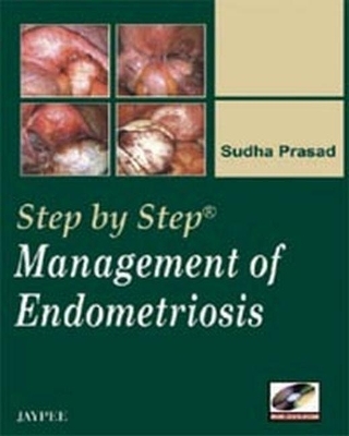 Step by Step: Management of Endometriosis