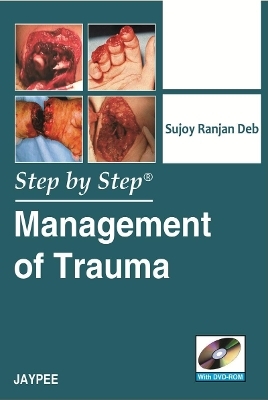 Step by Step: Management of Trauma