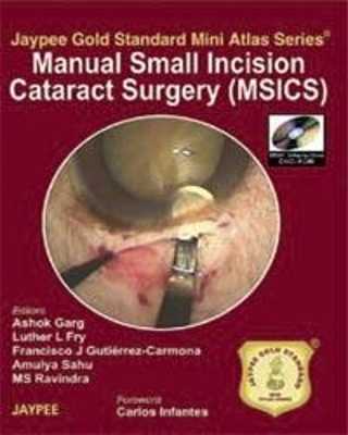 Jaypee Gold Standard Mini Atlas Series: Manual Small Incision Cataract Surgery (MSICS)