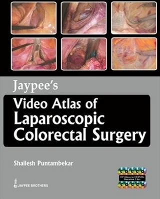 Jaypee's Video Atlas of  Laparoscopic Colorectal Surgery