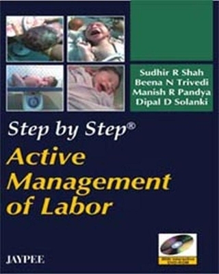 Step by Step: Active Management of Labor