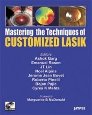 Mastering the Technique of Customized LASIK