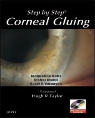Step by Step: Corneal Gluing