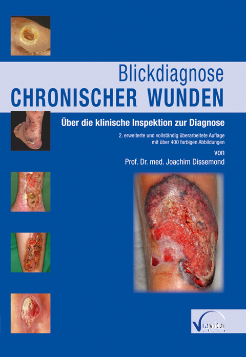 Blickdiagnose chronischer Wunden - Joachim Dissemond