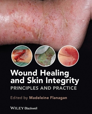 Wound Healing and Skin Integrity - Madeleine Flanagan