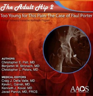 The Adult Hip: Case 2 (Acetabular Dysplasia)