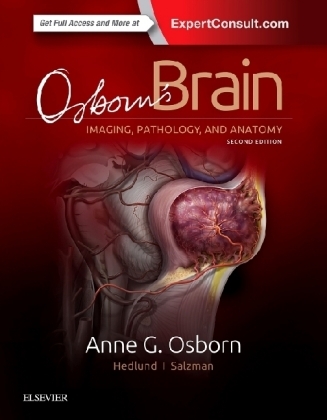 Osborn's Brain - Anne G. Osborn, Gary L. Hedlund, Karen L. Salzman