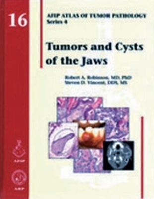 Tumors and Cysts of the Jaws - Robert A. Robinson, Steven D. Vincent