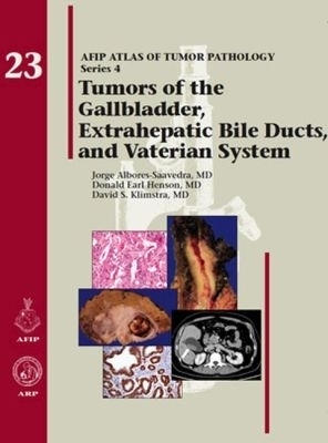 Tumors of the Gallbladder, Extrahepatic Bile Ducts, and Vaterian System - Jorge Albores-Saavedra, Donald Earl Henson, David S. Klimstra