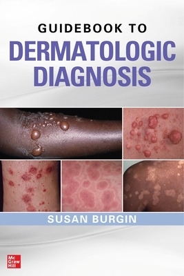 Guidebook to Dermatologic Diagnosis - Susan Burgin