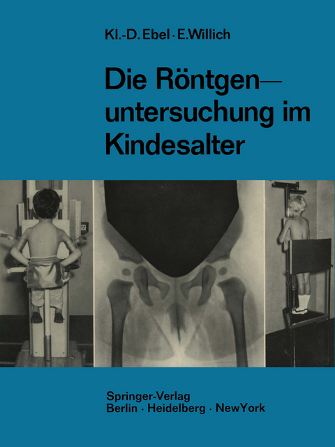 Die R&ouml;ntgenuntersuchung im Kindesalter - Klaus-Dietrich Ebel, Eberhard Willich