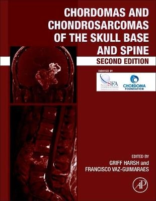 Chordomas and Chondrosarcomas of the Skull Base and Spine - 