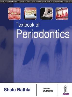 Textbook of Periodontics - Shalu Bathla