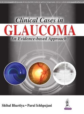 Clinical Cases in Glaucoma - Shibal Bhartiya, Parul Ichhpujani