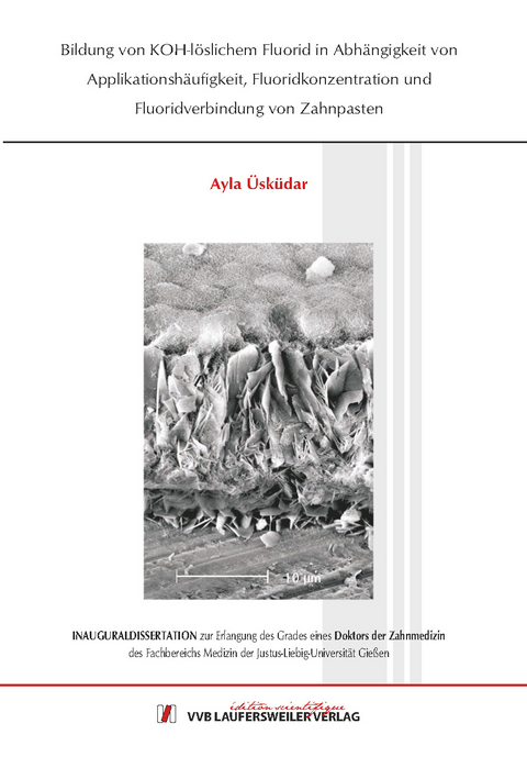 Bildung von KOH-l&ouml;slichem Fluorid in Abh&auml;ngigkeit von Applikationsh&auml;ufigkeit, Fluoridkonzentration und Fluoridverbindung von Zahnpasten - Ayla &Uuml;sk&uuml;dar