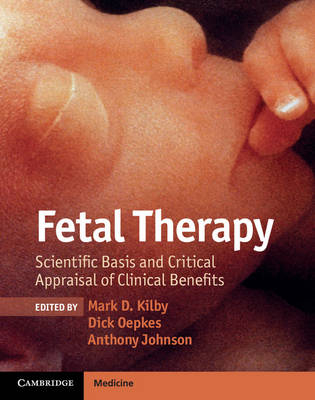 Fetal Therapy - 