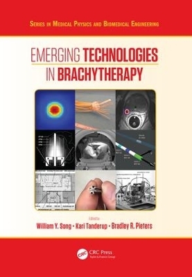 Emerging Technologies in Brachytherapy - 