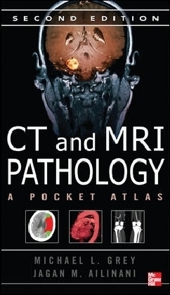 CT & MRI Pathology: A Pocket Atlas, Second Edition