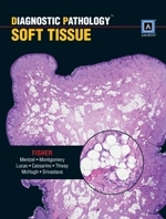 Diagnostic Pathology: Soft Tissue Tumors