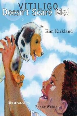 Vitiligo Doesn't Scare Me - Kim Kirkland