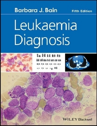 Leukaemia Diagnosis