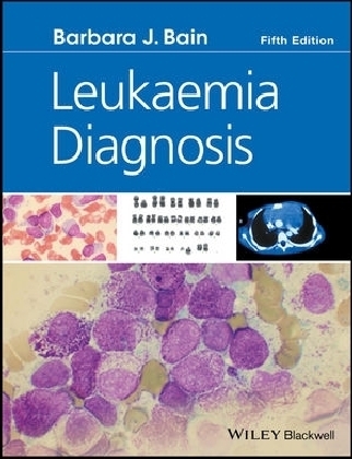 Leukaemia Diagnosis - Barbara Jane Bain