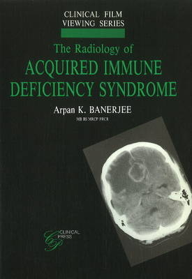 Radiology of Acquired Immune Deficiency Syndrome - Arpan K Banerjee