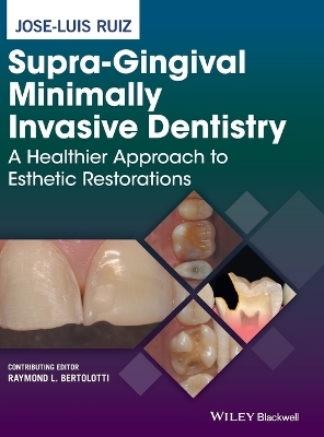 Supra-Gingival Minimally Invasive Dentistry