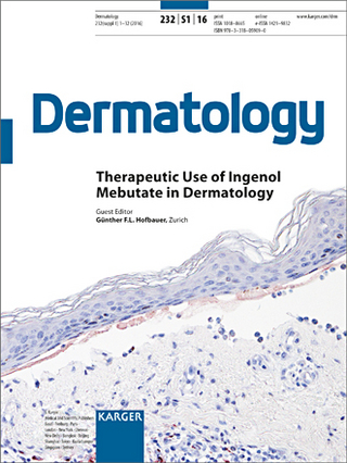 Therapeutic Use of Ingenol Mebutate in Dermatology