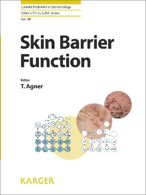 Skin Barrier Function - 