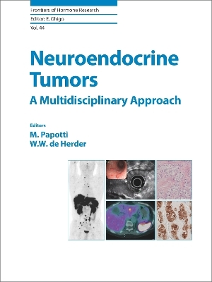 Neuroendocrine Tumors: A Multidisciplinary Approach - 