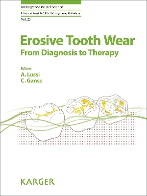 Erosive Tooth Wear