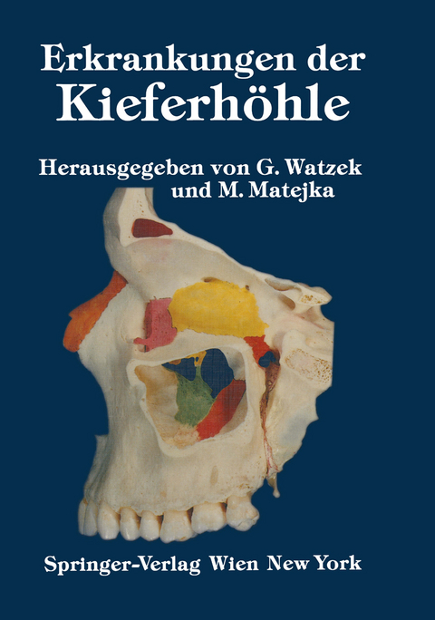 Erkrankungen der Kieferh&ouml;hle - 