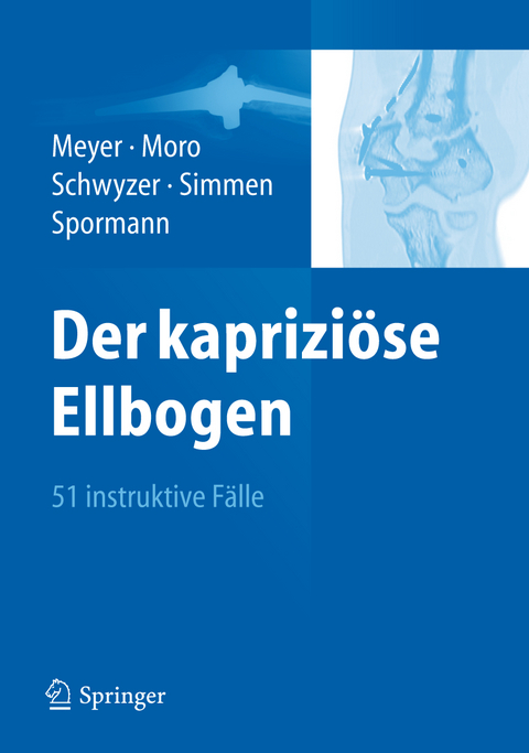 Der kaprizi&ouml;se Ellbogen - 