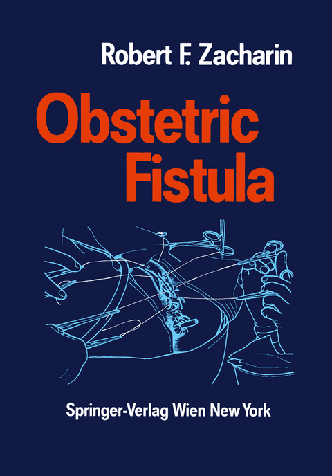 Obstetric Fistula - Robert F. Zacharin