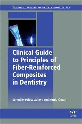 Clinical Guide to Principles of Fiber-Reinforced Composites in Dentistry