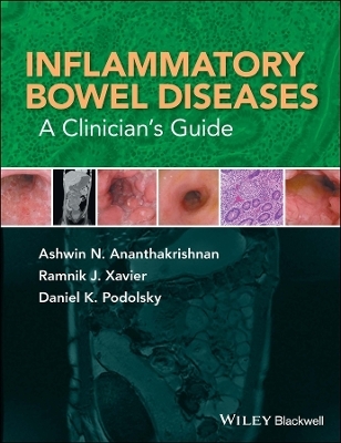Inflammatory Bowel Diseases - Ashwin N. Ananthakrishnan, Ramnik J. Xavier, Daniel K. Podolsky