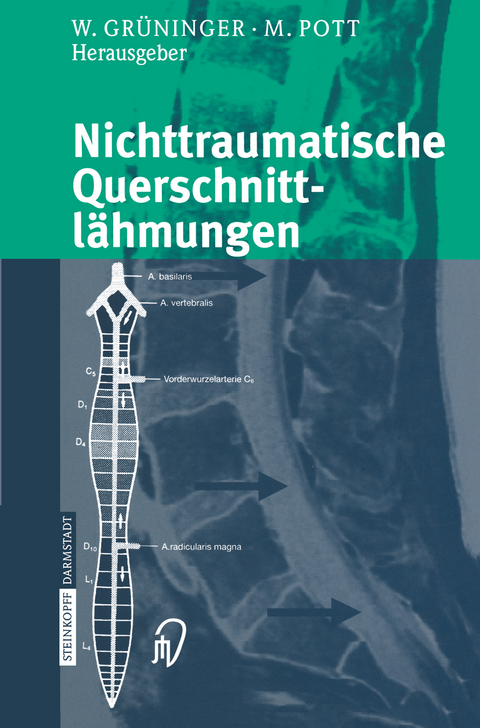 Nichttraumatische Querschnittl&auml;hmungen - 