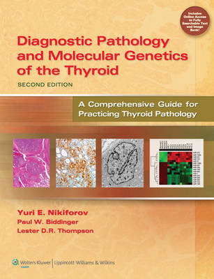 Diagnostic Pathology and Molecular Genetics of the Thyroid