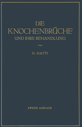 Die Knochenbrüche und ihre Behandlung