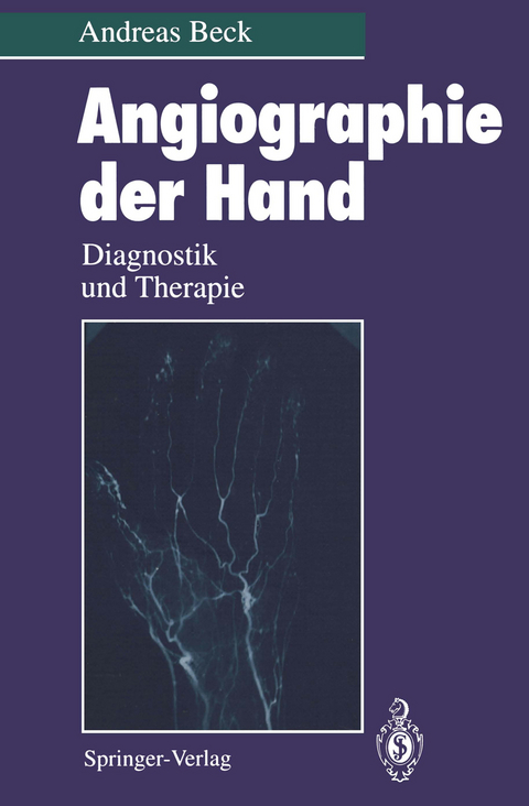 Angiographie der Hand - Andreas Beck