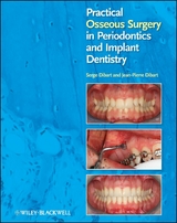 Practical Osseous Surgery in Periodontics and Implant Dentistry - Serge Dibart, Jean-Pierre Dibart